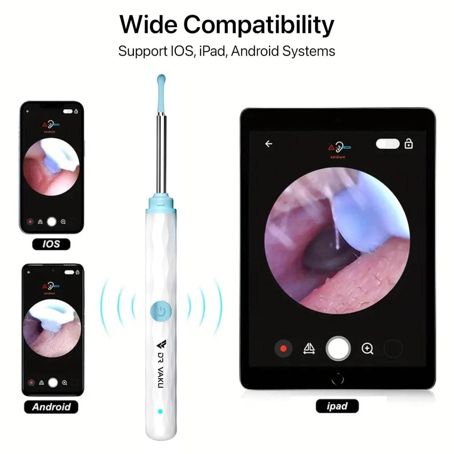 Smart Visual Ear Wax Cleaner - Best Deals at BeSh Deals®