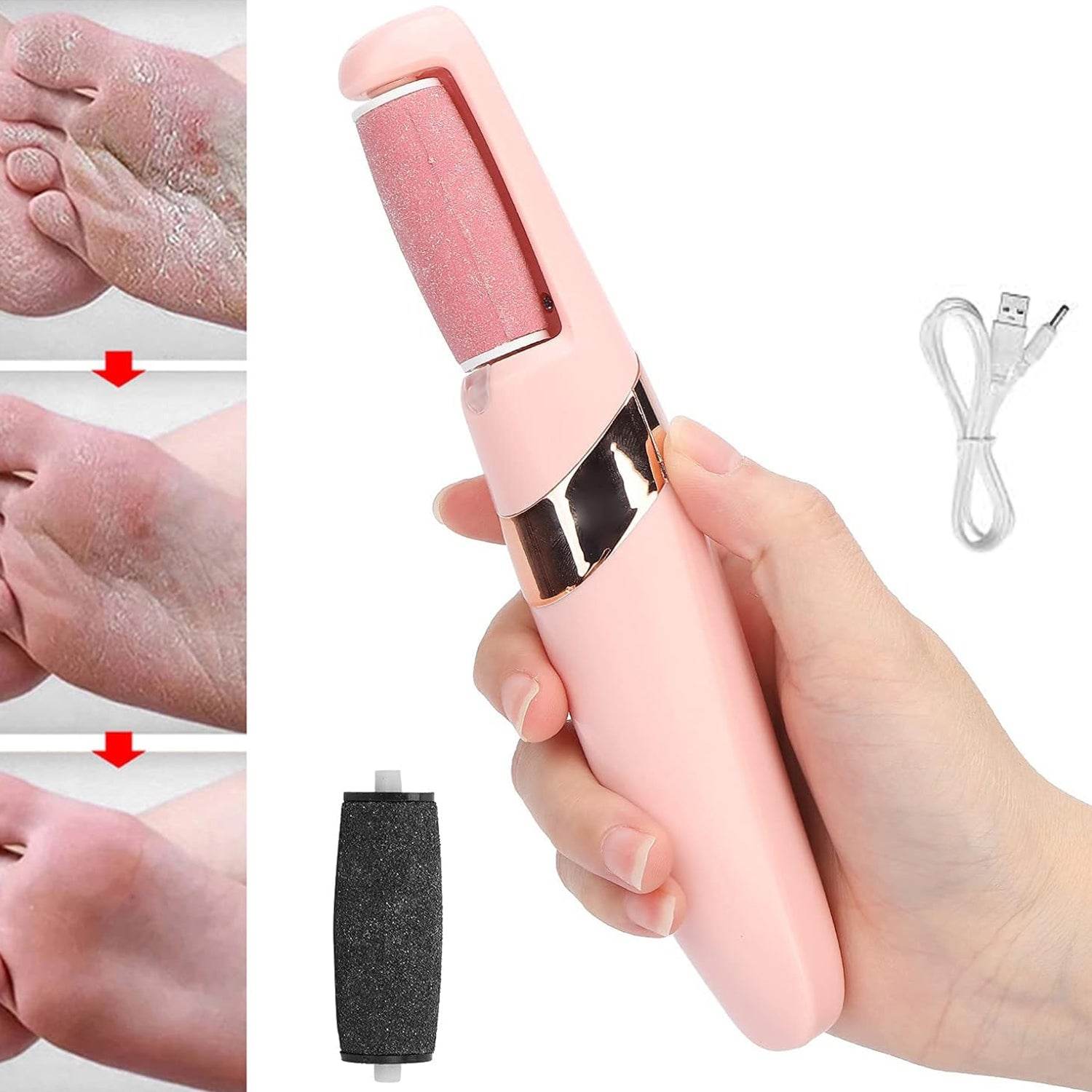 Flewless Pedi Electronic Pedicure Tool (1 Set) - Best Deals at BeSh Deals®
