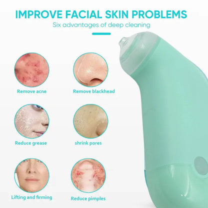 0288 Vacuum Blackhead Machine Reduce Spot Mini Handheld Lifting Massage Facial Blackhead Remover For Skin Care (1 Pc) - Best Deals at BeSh Deals®