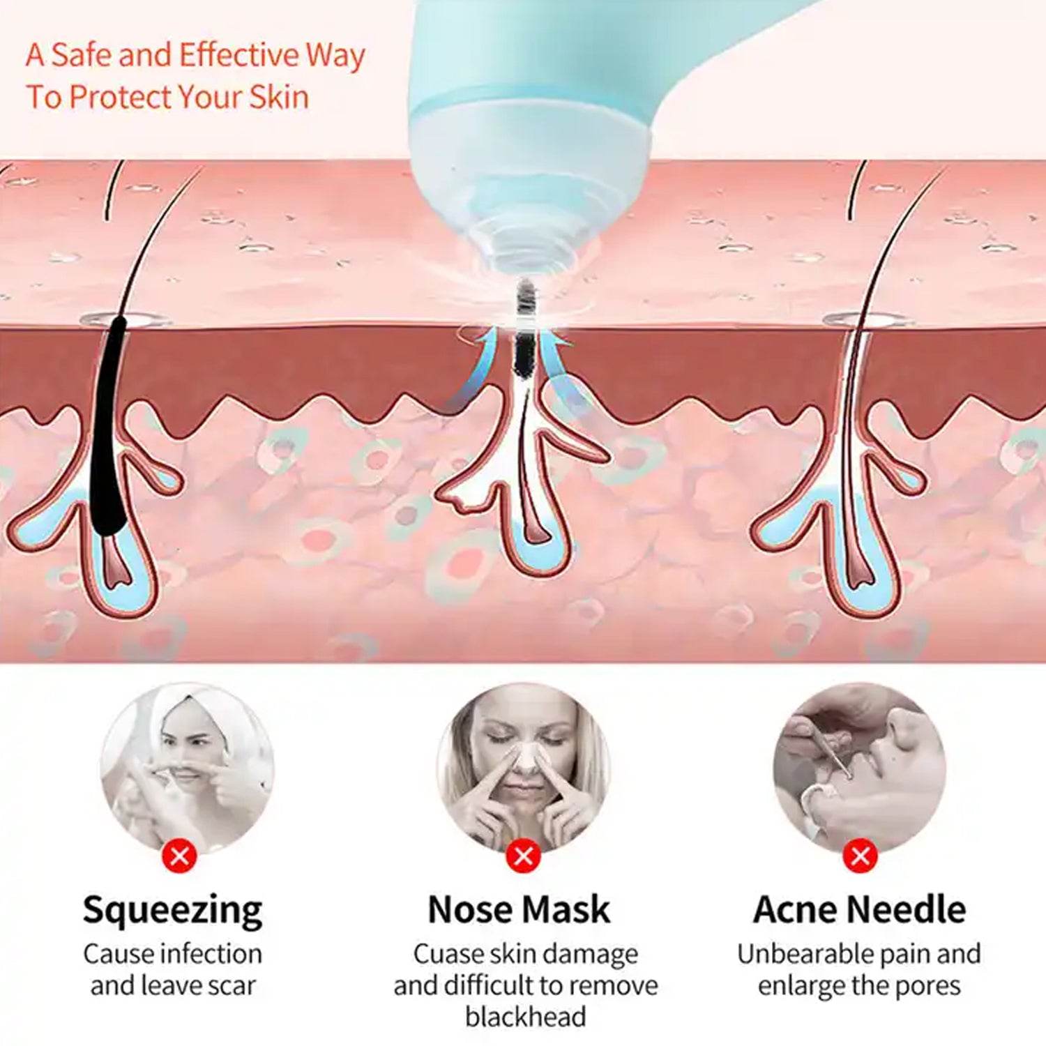 0288 Vacuum Blackhead Machine Reduce Spot Mini Handheld Lifting Massage Facial Blackhead Remover For Skin Care (1 Pc) - Best Deals at BeSh Deals®