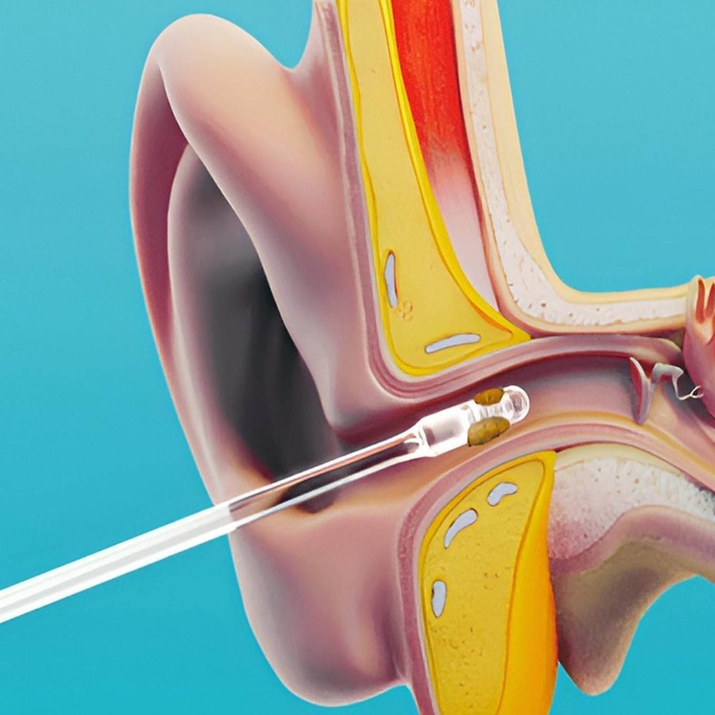 Ear Wax Cleaner Stick Silicone Reusable Sticky Ear Wax Removal Kit (12 Pcs Set) - Best Deals at BeSh Deals®